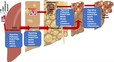 Hepatic macrophage mediated immune response in liver steatosis driven carcinogenesis